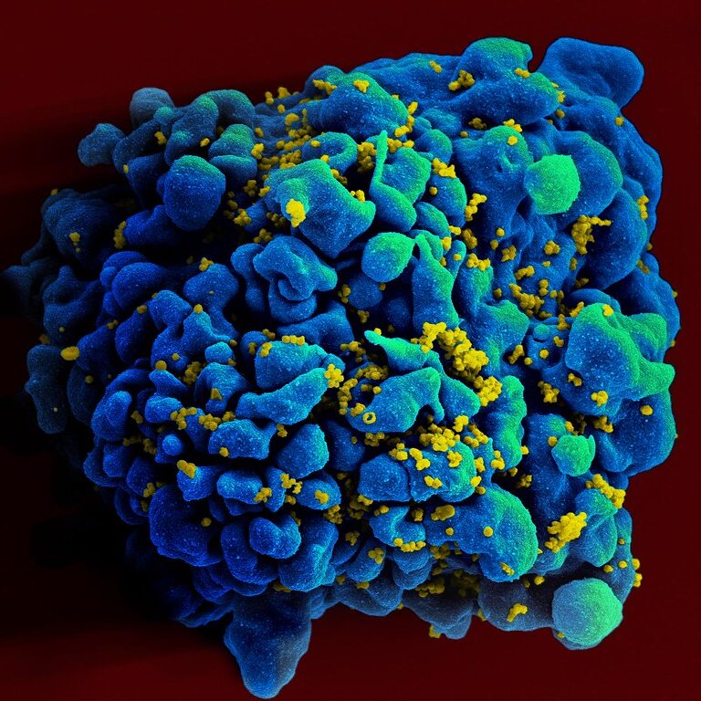 White blood cell being attacked by HIV