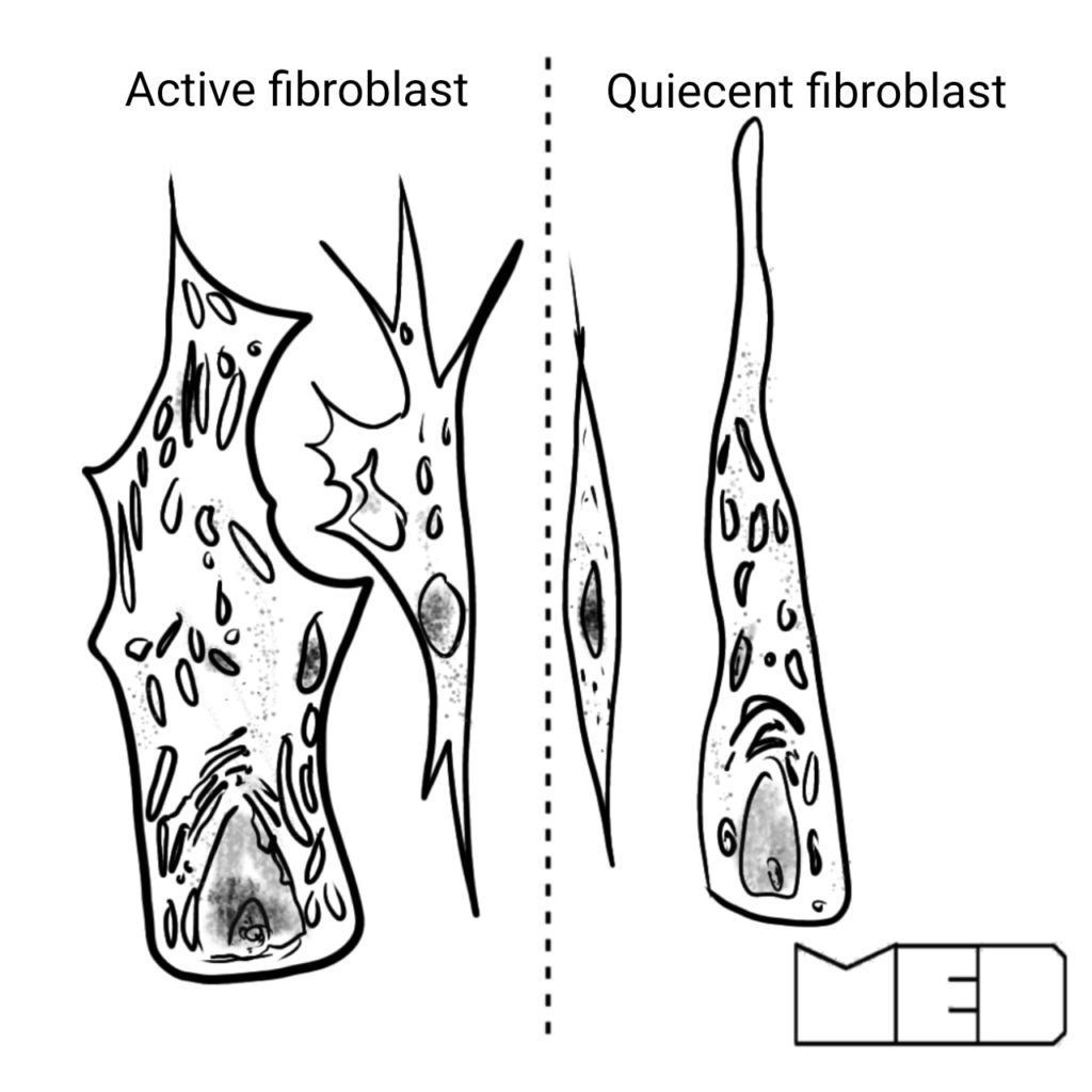 active vs quiecent fibroblasts in connective tissue