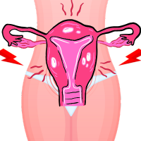 Endometriosis and Adenomyosis