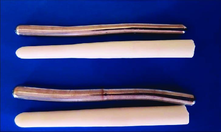 Treatment of anorectal malformations via hangars dilator/ candle