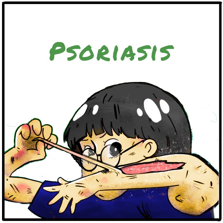 Psoriasis Cartoon image