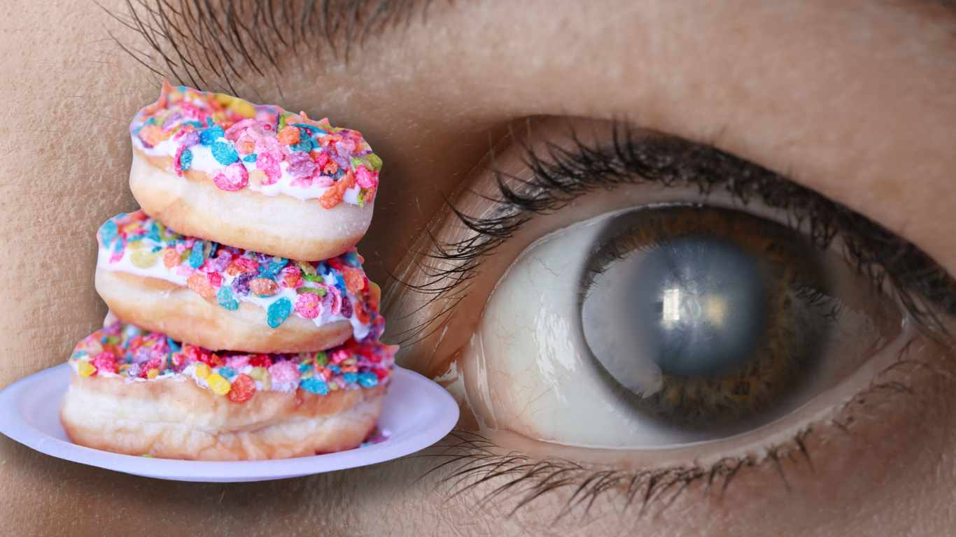 Diabetic cataract mechanism