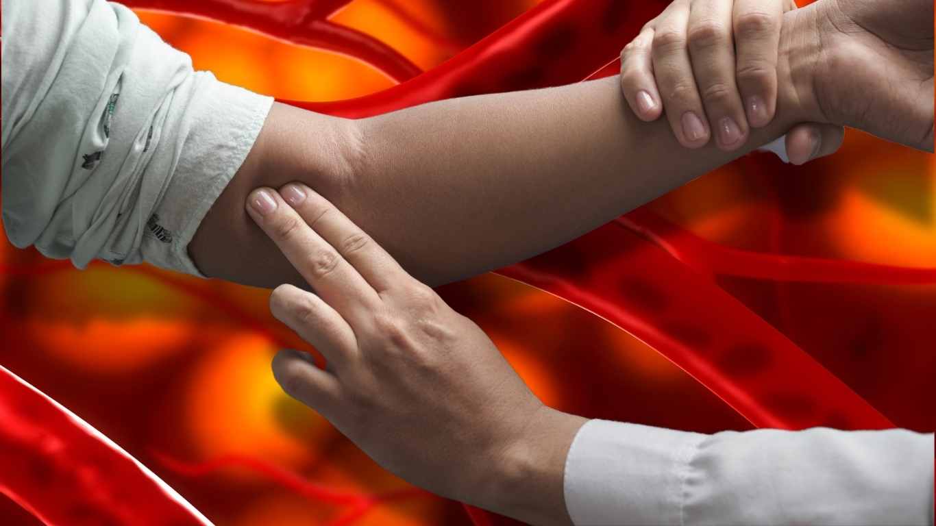 Brachial Artery Pulse