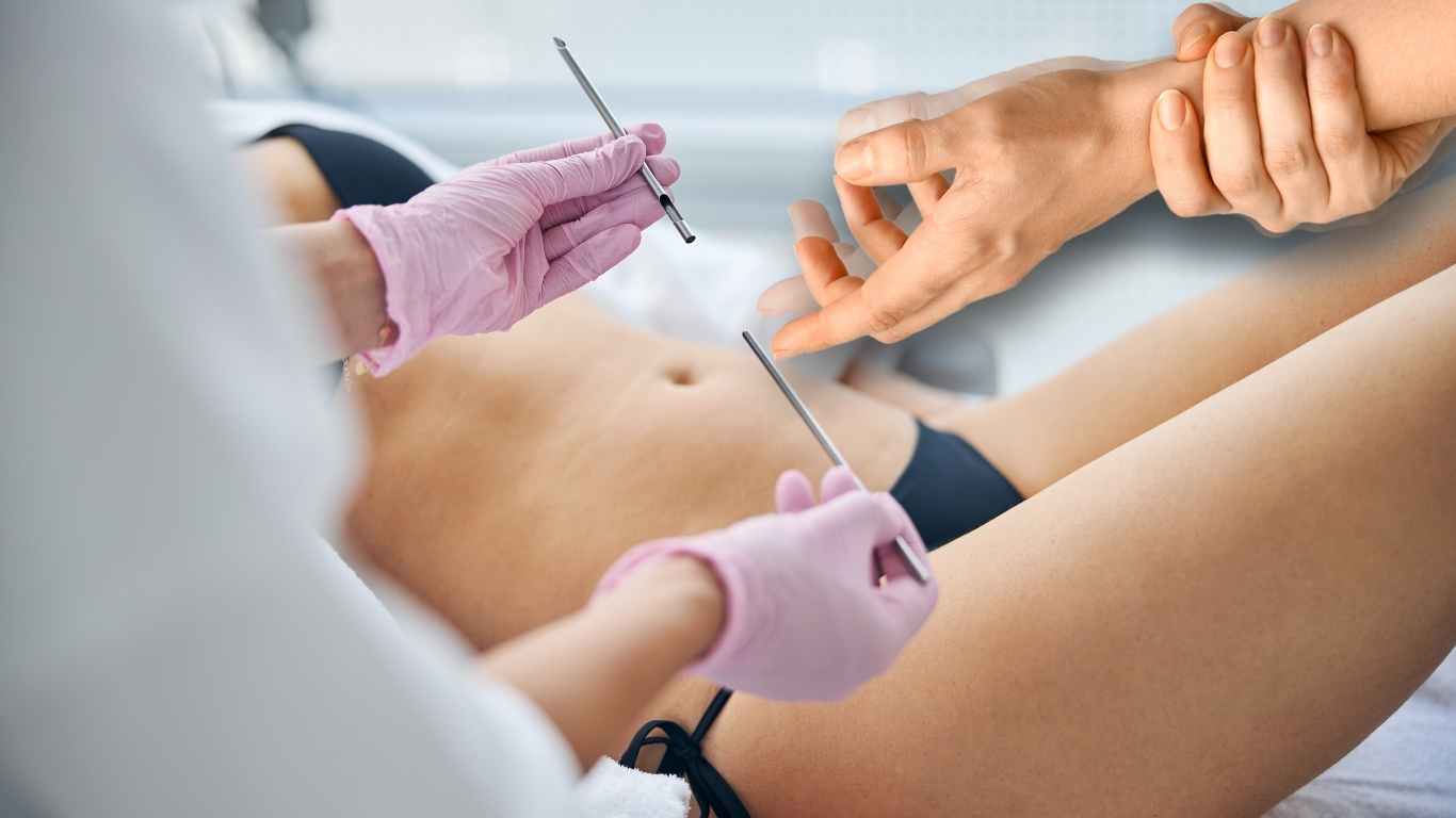 Skin Biopsy For Parkinson’s Disease